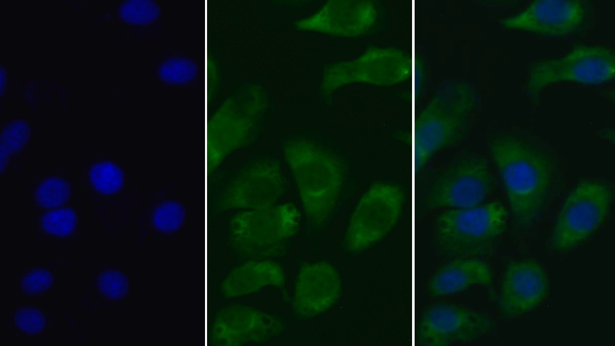 Monoclonal Antibody to Anti-Mullerian Hormone (AMH)