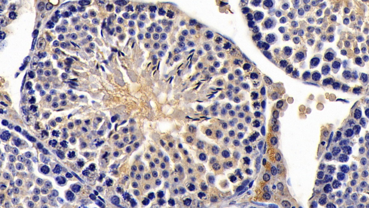 Monoclonal Antibody to Anti-Mullerian Hormone (AMH)