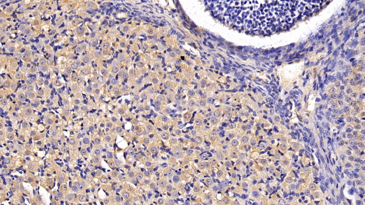 Monoclonal Antibody to Anti-Mullerian Hormone (AMH)