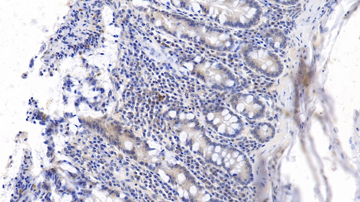 Monoclonal Antibody to Beta-2-Microglobulin (b2M)