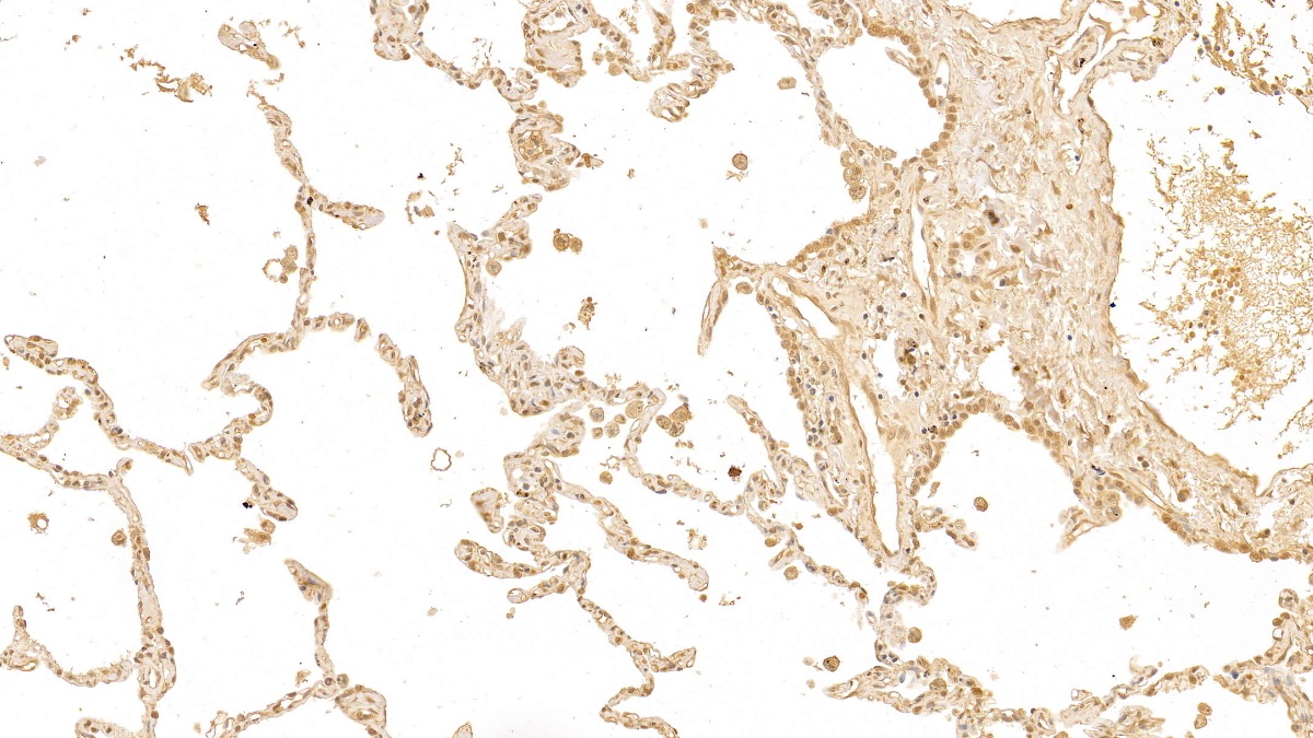 Monoclonal Antibody to Galectin 3 (GAL3)