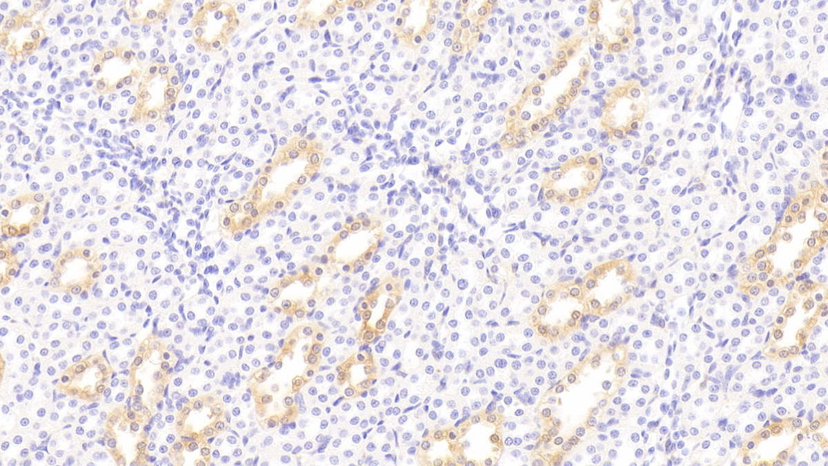 Monoclonal Antibody to Galectin 3 (GAL3)