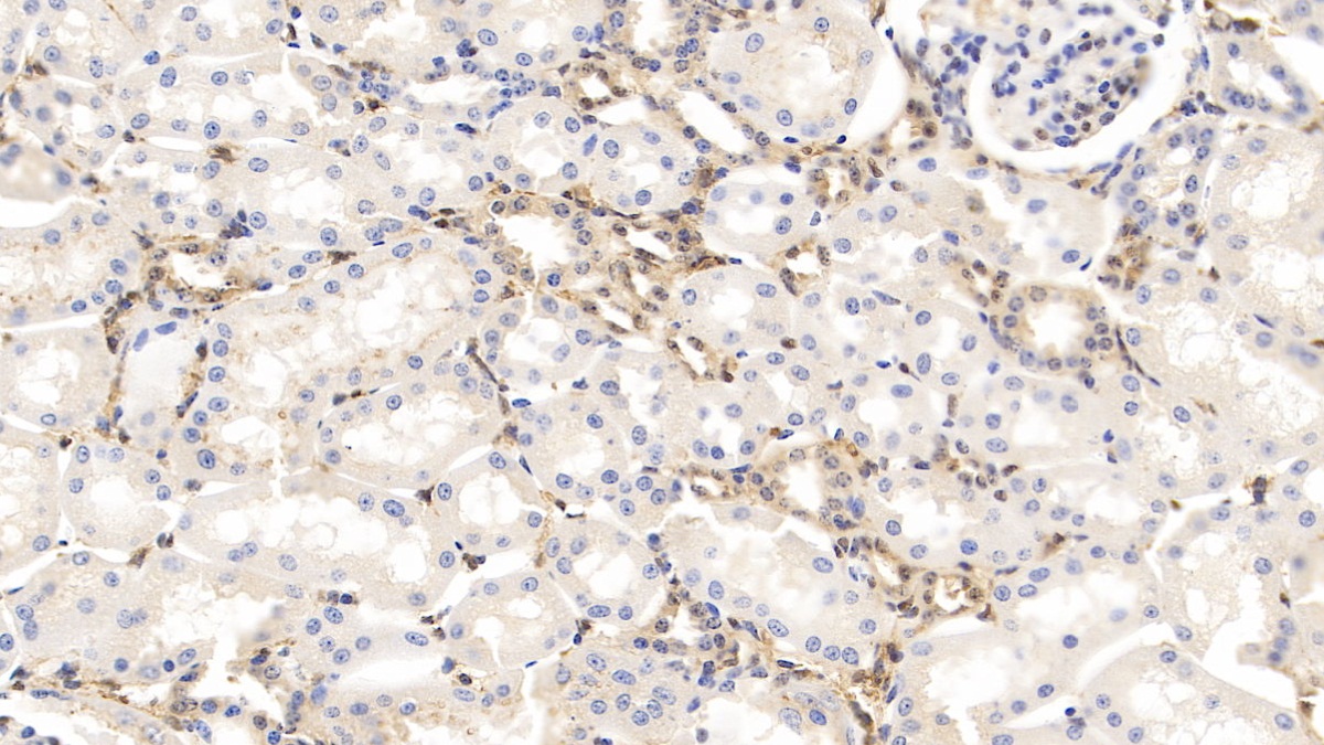 Monoclonal Antibody to Gelsolin (GSN)