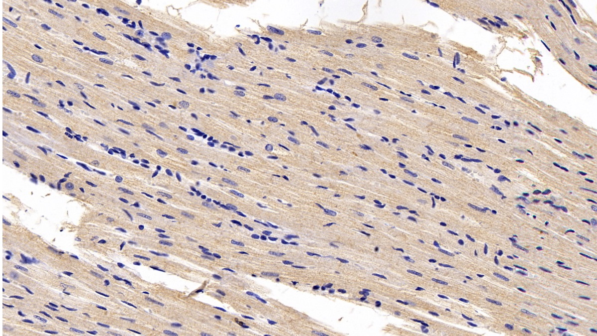 Monoclonal Antibody to Desmin (Des)