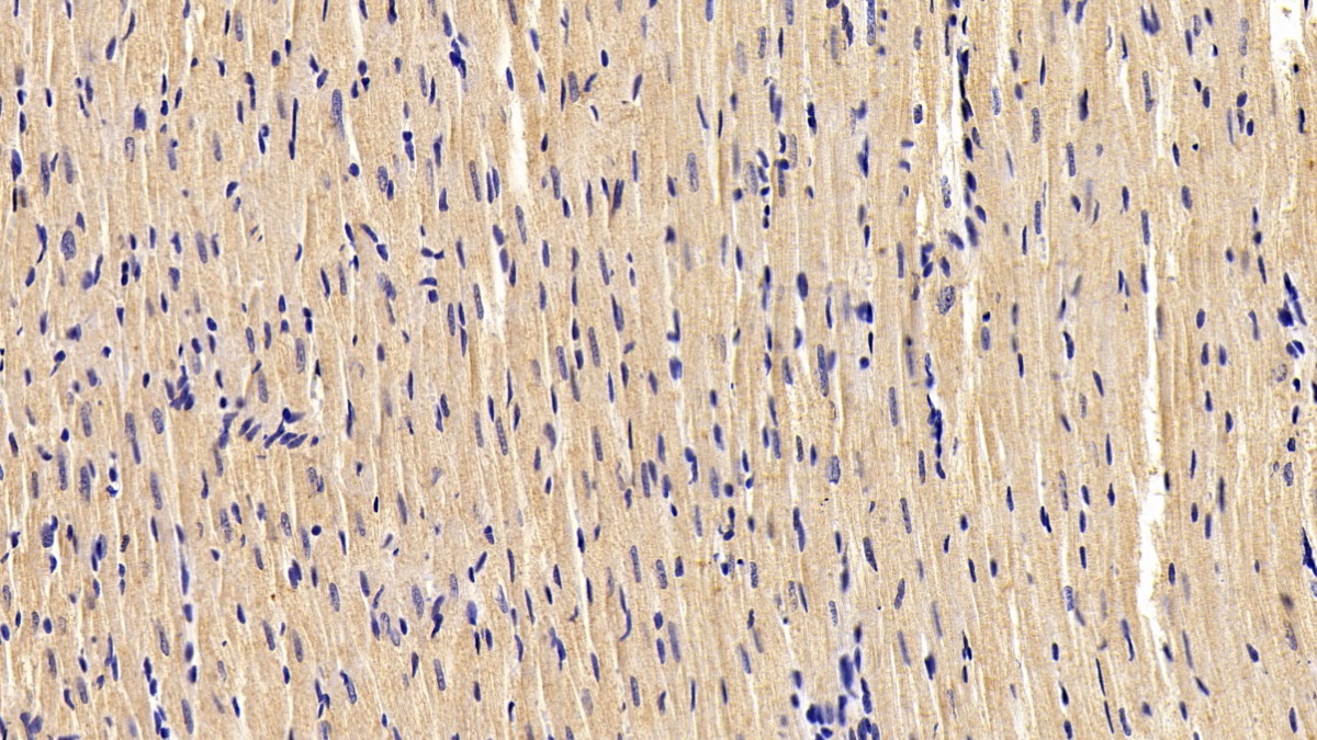 Monoclonal Antibody to Desmin (Des)