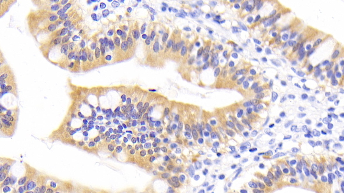 Monoclonal Antibody to Retinol Binding Protein 2, Cellular (RBP2)