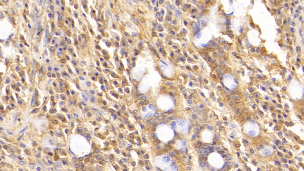 Monoclonal Antibody to Complement Component 5a (C5a)