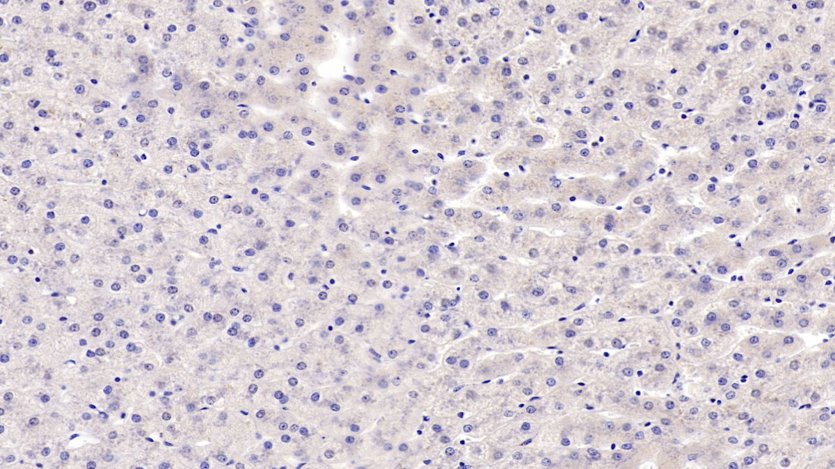 Monoclonal Antibody to Alpha-Hemoglobin Stabilizing Protein (aHSP)