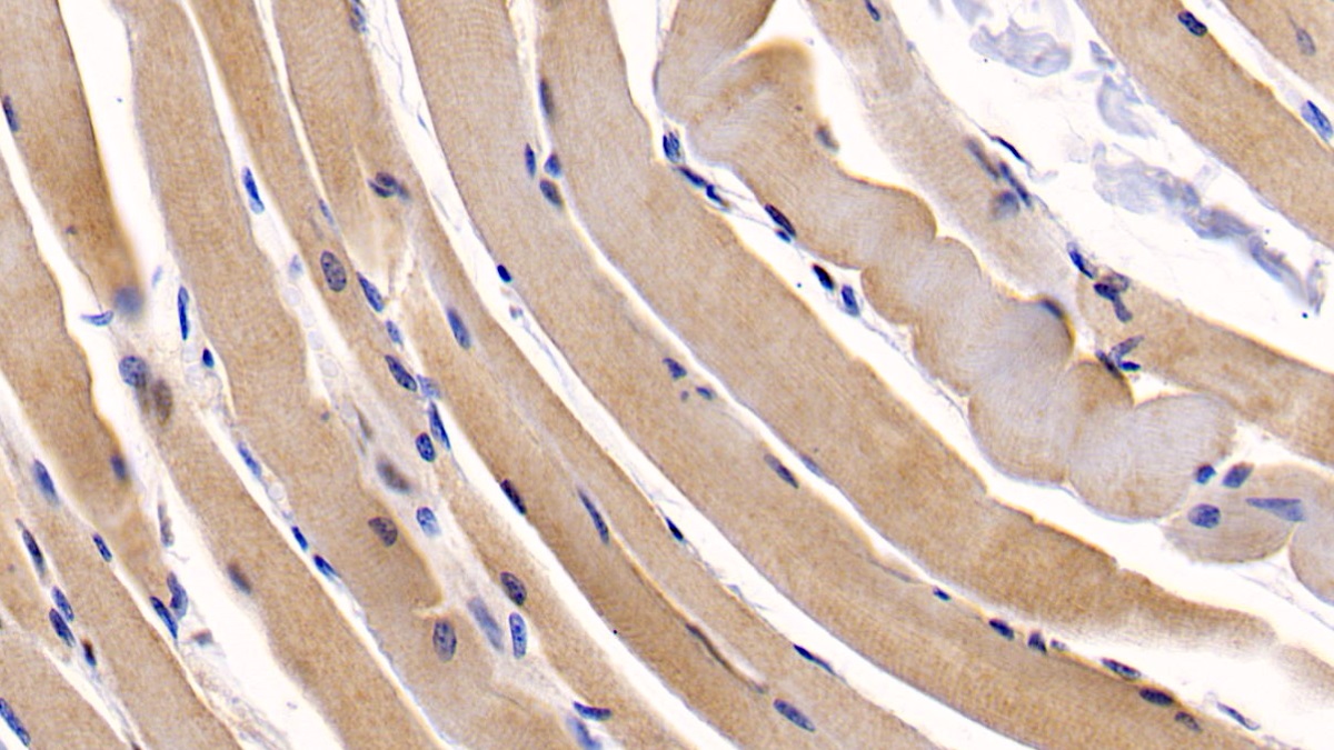 Monoclonal Antibody to Osteocalcin (OC)