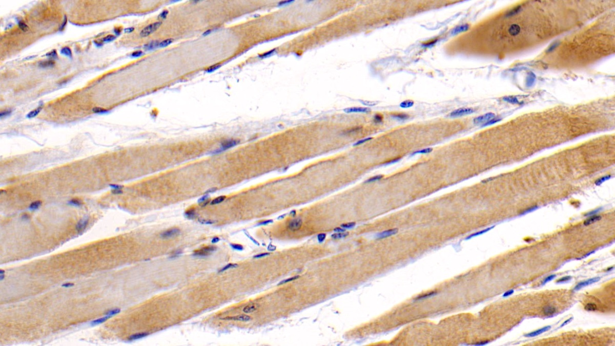 Monoclonal Antibody to Osteocalcin (OC)