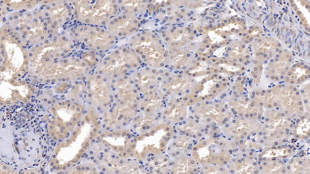 Monoclonal Antibody to Osteocalcin (OC)