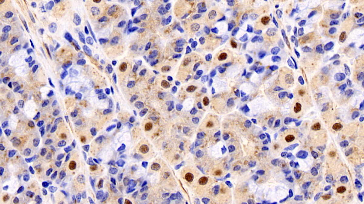 Monoclonal Antibody to N-Terminal Pro-Atrial Natriuretic Peptide (NT-ProANP)
