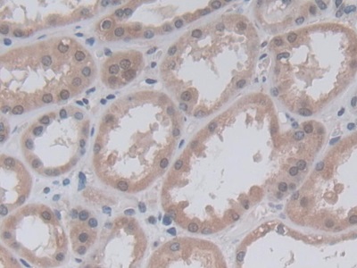 Monoclonal Antibody to Nestin (NES)