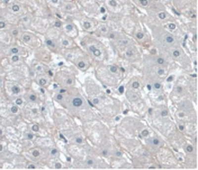 Monoclonal Antibody to Apolipoprotein A1 (APOA1)