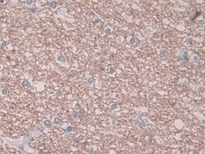 Monoclonal Antibody to Plasminogen Activator Inhibitor 1 (PAI1)