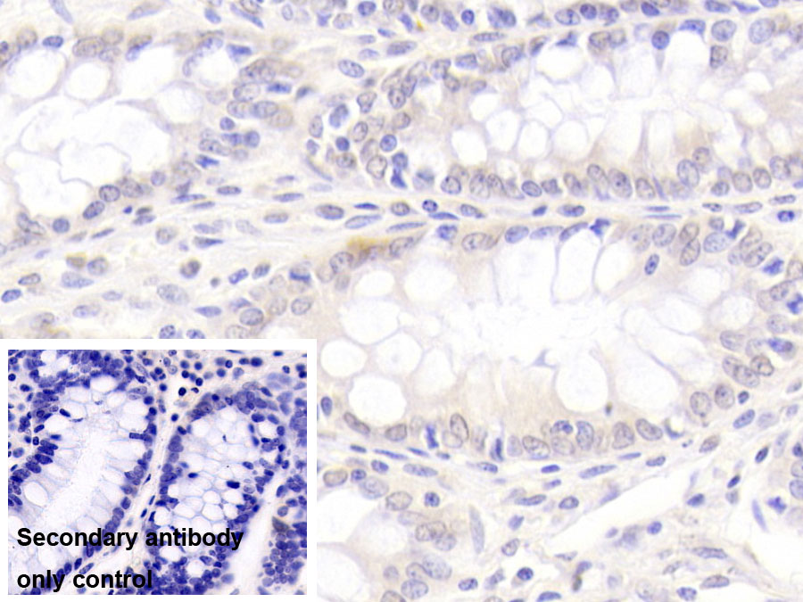 Monoclonal Antibody to Plasminogen Activator Inhibitor 1 (PAI1)