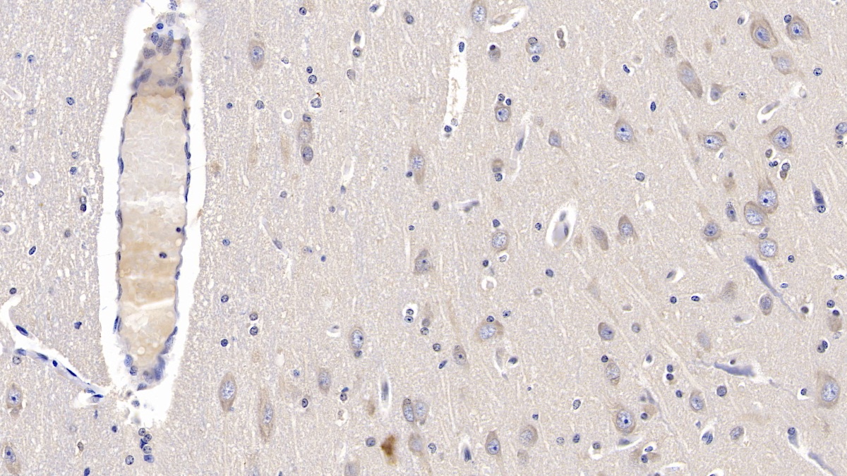 Monoclonal Antibody to Myelin Basic Protein (MBP)