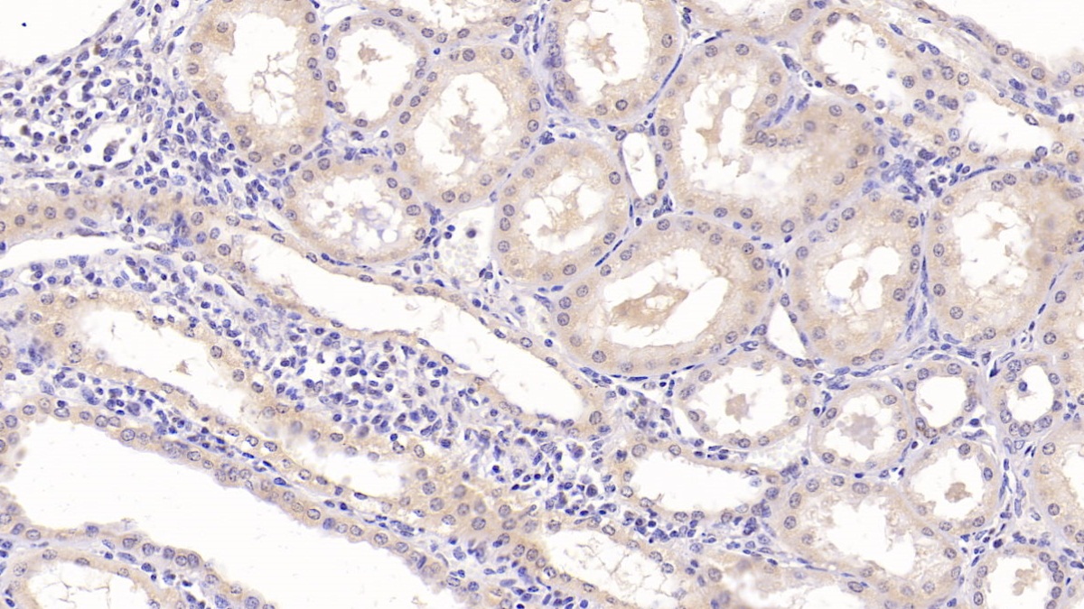 Monoclonal Antibody to Epidermal Growth Factor (EGF)