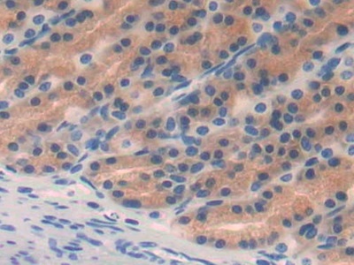 Monoclonal Antibody to Epidermal Growth Factor (EGF)