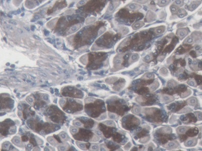 Monoclonal Antibody to Somatostatin (SST)