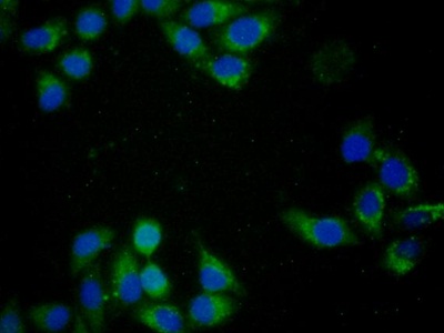 Monoclonal Antibody to Cytochrome C (CYCS)