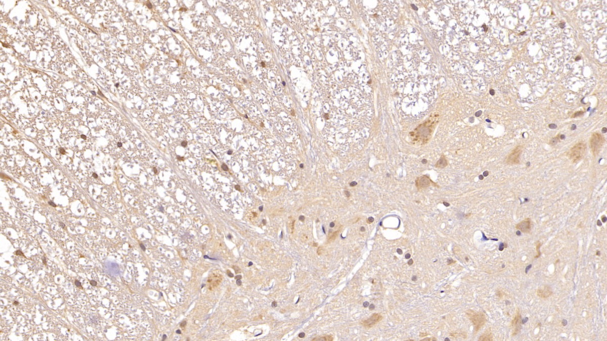 Monoclonal Antibody to Adiponectin (ADPN)