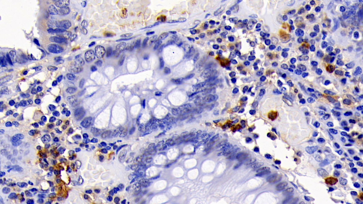 Monoclonal Antibody to Caspase 3 (CASP3)