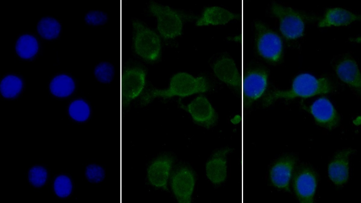 Monoclonal Antibody to Complement component 1 Q subcomponent-binding protein, mitochondrial (C1QBP)
