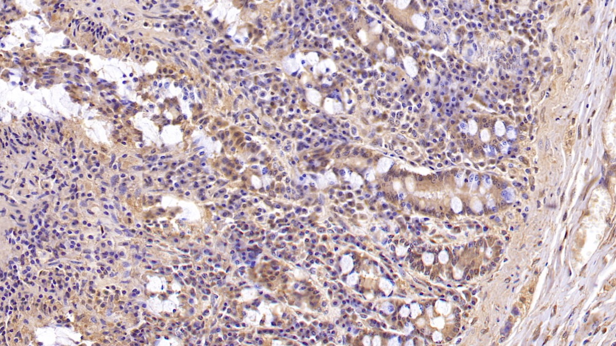 Monoclonal Antibody to Mucin 5 Subtype B (MUC5B)