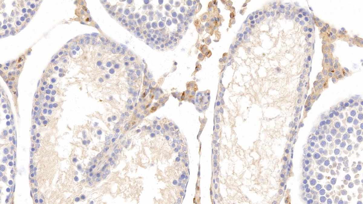 Monoclonal Antibody to Apolipoprotein E (APOE)