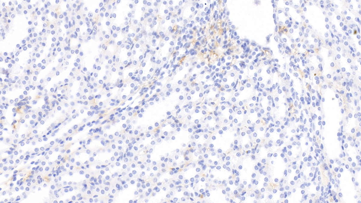 Monoclonal Antibody to Apolipoprotein E (APOE)