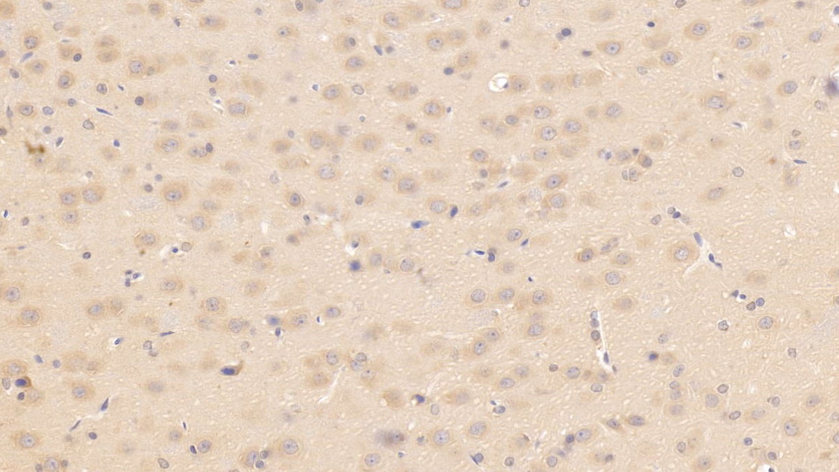 Monoclonal Antibody to Apolipoprotein E (APOE)
