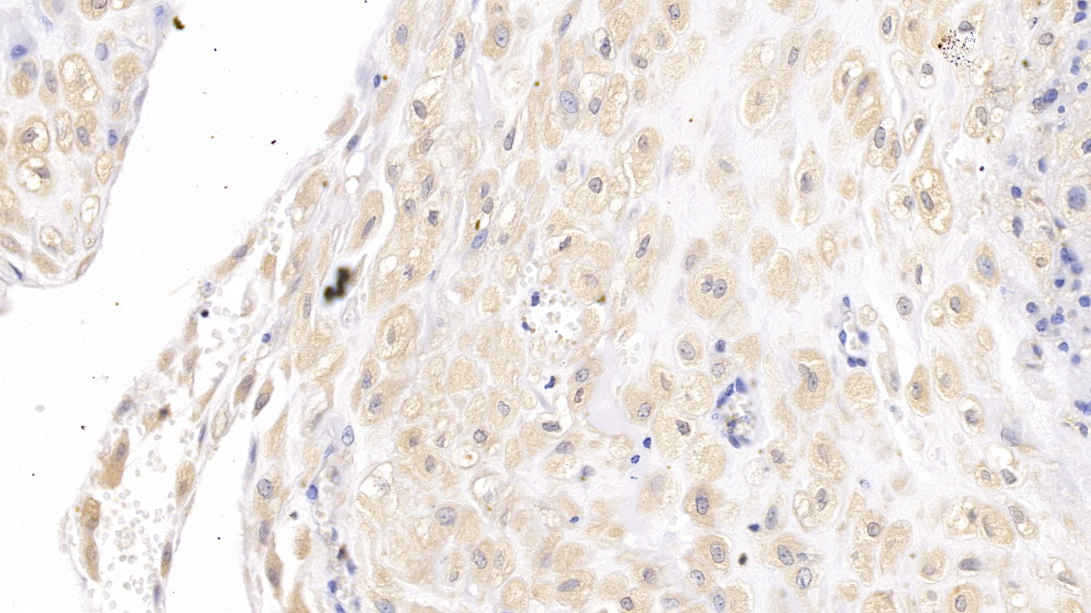 Monoclonal Antibody to Epidermal Growth Factor Receptor (EGFR)