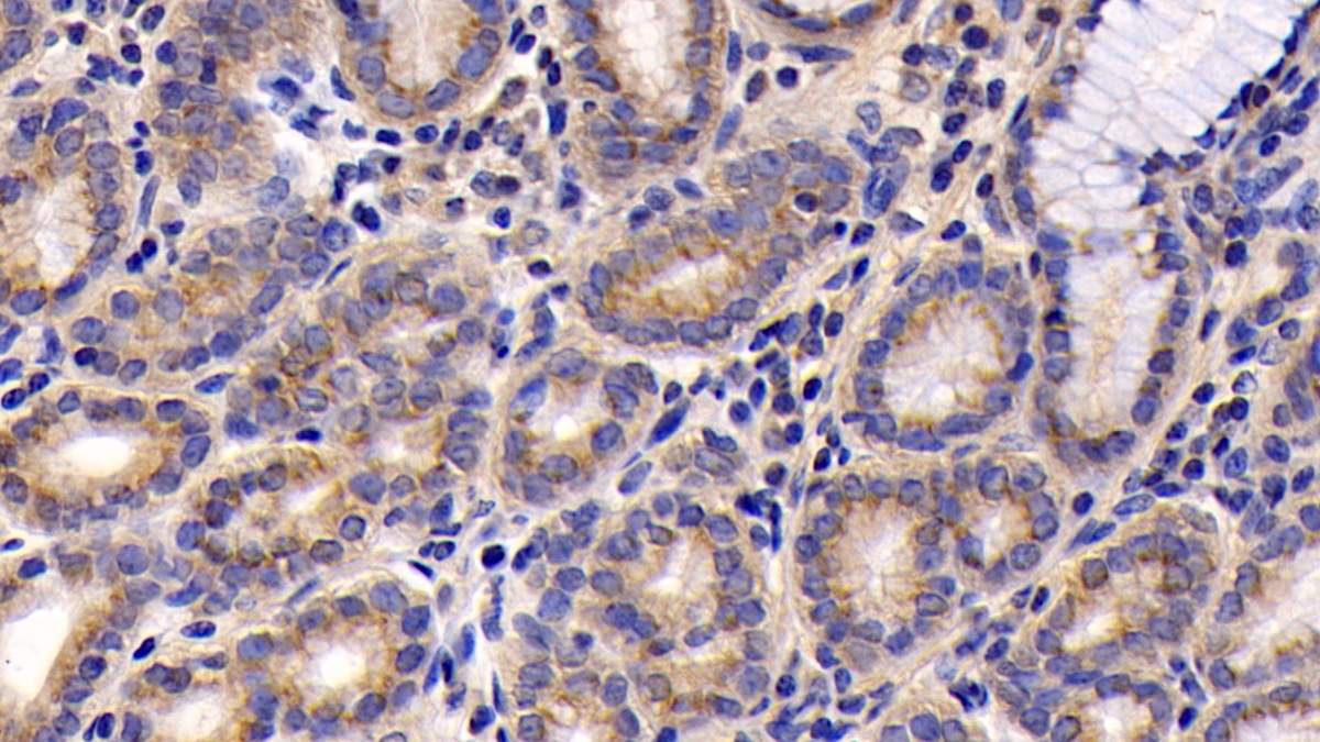 Monoclonal Antibody to Chemokine C-X-C-Motif Ligand 16 (CXCL16)