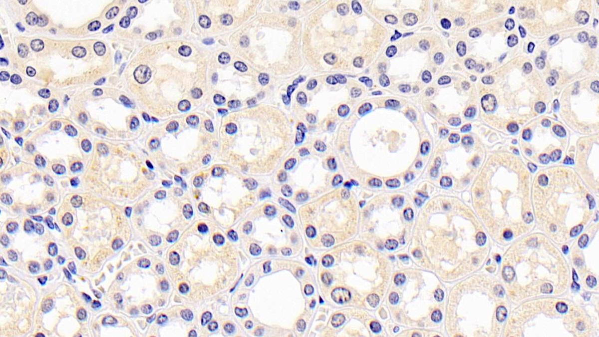 Monoclonal Antibody to Kidney Injury Molecule 1 (Kim1)