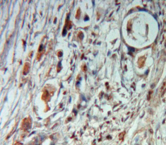 Monoclonal Antibody to Cholecystokinin (CCK)