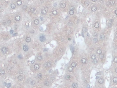 Monoclonal Antibody to Alpha-1-Acid Glycoprotein (a1AGP)