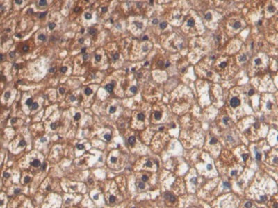 Monoclonal Antibody to Haptoglobin (Hpt)