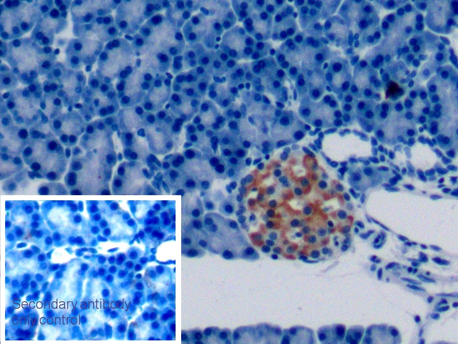 Monoclonal Antibody to Parathyroid Hormone Related Protein (PTHrP)