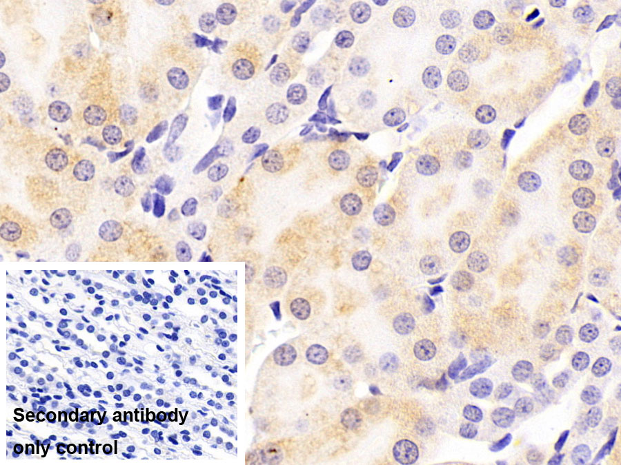 Monoclonal Antibody to Coagulation Factor II (F2)