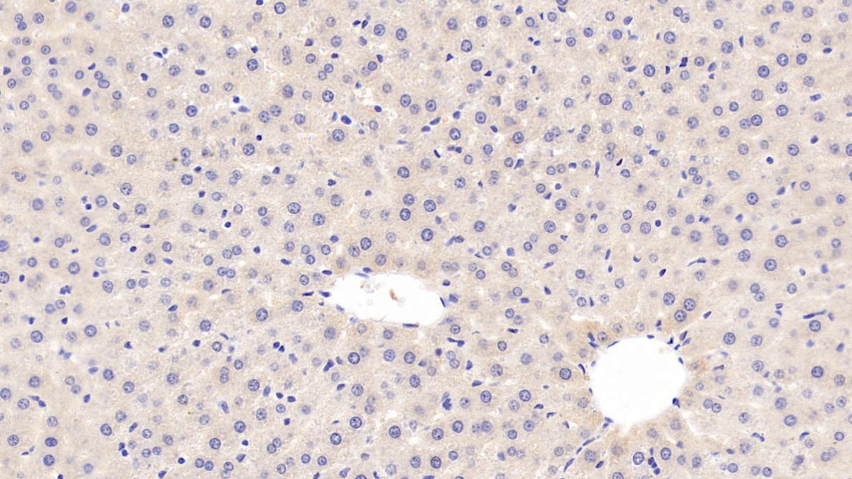 Monoclonal Antibody to C Reactive Protein (CRP)