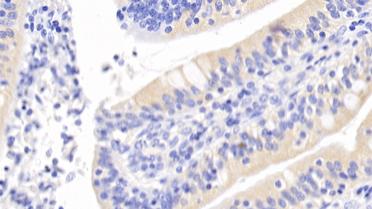 Monoclonal Antibody to Inhibin Beta A (INHbA)