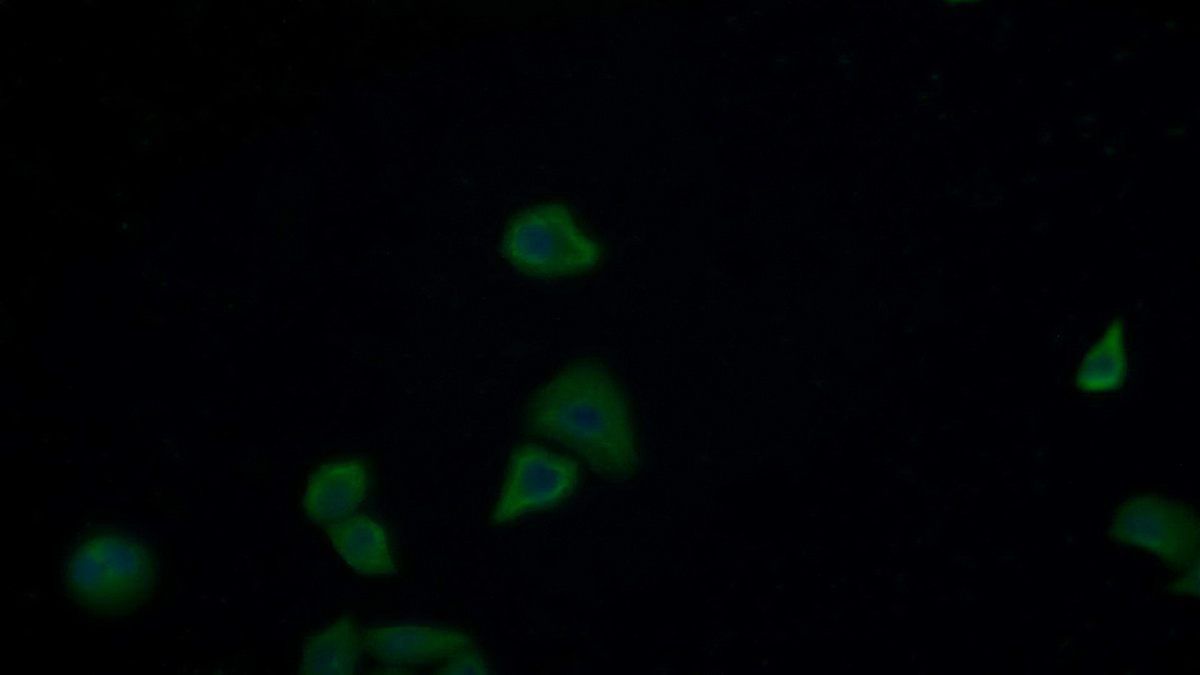 Monoclonal Antibody to Insulin Receptor (INSR)