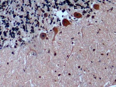 Monoclonal Antibody to Endoglin (ENG)