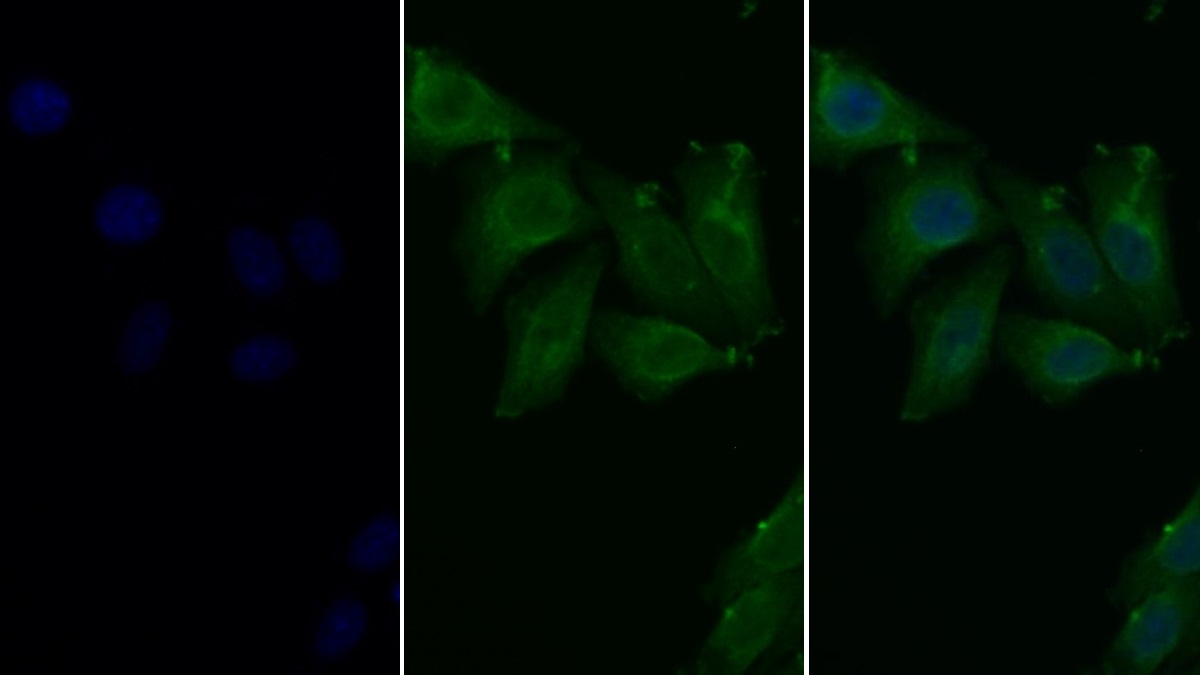 Monoclonal Antibody to Albumin (ALB)