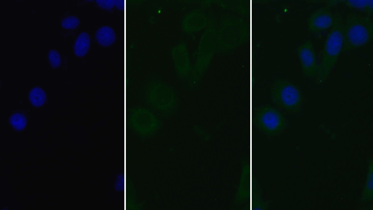 Monoclonal Antibody to Surfactant Associated Protein D (SPD)