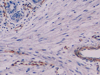 Monoclonal Antibody to Vimentin (VIM)