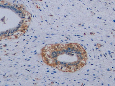 Monoclonal Antibody to Vimentin (VIM)