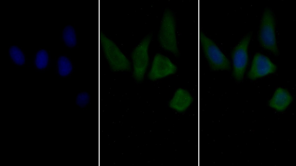 Monoclonal Antibody to Vimentin (VIM)