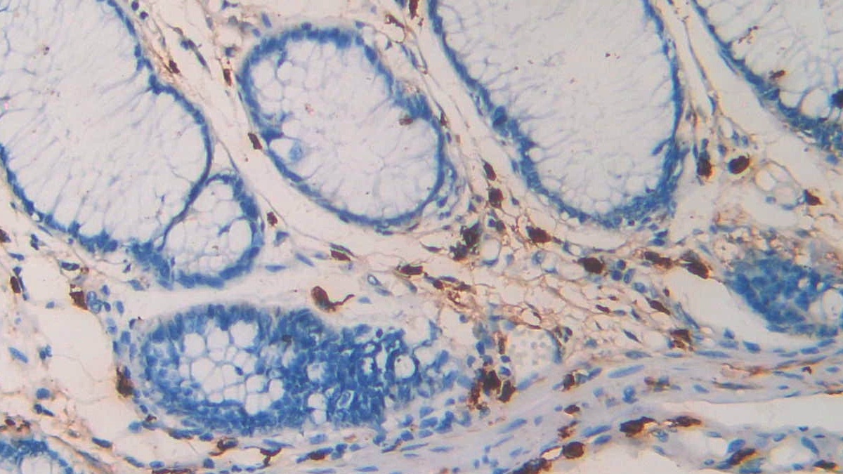 Monoclonal Antibody to Tryptase (TPS)